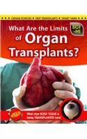 What Are the Limits of Organ Transplants? (Sci-Hi)