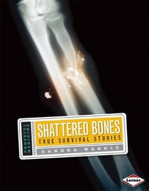 Shattered Bones: True Survival Stories (Powerful Medicine)