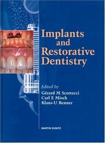 Implants and Restorative Dentistry