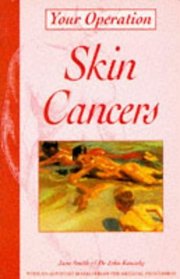 Skin Cancers (Your Operation)