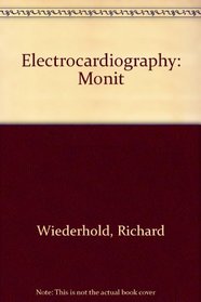 Electrocardiography: Monit