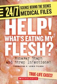 Help! What's Eating My Flesh?: Runaway Staph and Strep Infections! (24/7: Science Behind the Scenes)
