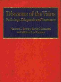 Diseases of the Veins: Pathology, Diagnosis and Treatment