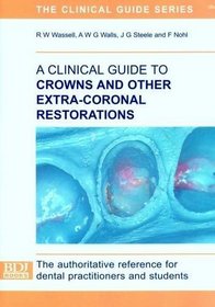 A Clinical Guide to Crowns and Other Extra-coronal Restorations
