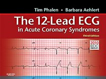 12-Lead ECG in Acute Coronary Syndromes Pocket Reference for the 12-Lead ECG in Acute Coronary Syndromes