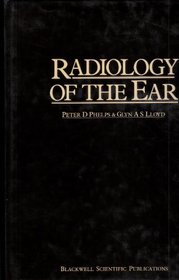 Radiology of the Ear