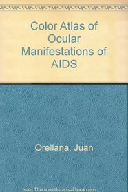 Color Atlas of Ocular Manifestations of AIDS: Diagnosis and Management