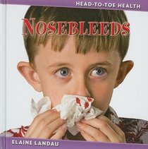 Nosebleeds (Head-to-Toe Health)