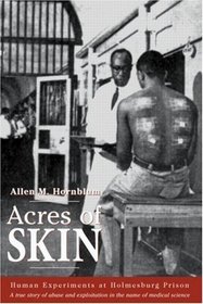 Acres of Skin: Human Experiments at Holmesburg Prison : A True Story of Abuse and Exploitation in the Name of Medical Science