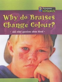 Why Do Bruises Change Colour? (Body Matters)