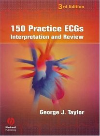 150 Practice Ecgs: Interpretation And Review: Interpretation And Review