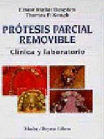 Protesis Parcial Removiable Colada: Clinica Y Laboratorio (Spanish Edition)
