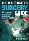 The Illustrated Surgery Guide - 20 Common Operations Explained Step By Step