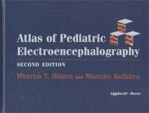 Atlas of Pediatric Electroencephalography (Books)