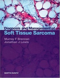 Diagnosis and Management of Sarcoma