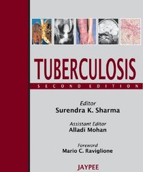 Tuberculosis