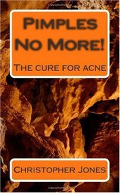 Pimples No More! - The cure for acne
