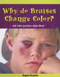 Why Do Bruises Change Color?: And Other Questions about Blood (Body Matters (Sagebrush))