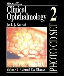 External Eye Disease (Clinical Ophthalmology Photo CD Set , Vol 2)