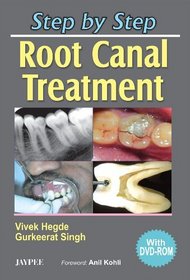 Step by Step Root Canal Treatment with DVD-ROM