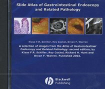 Slide Atlas of Gastrointestinal Endoscopy and Related Pathology: CD-ROM