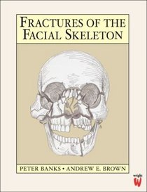 Fractures of the Facial Skeleton