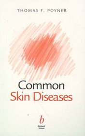 Common Skin Diseases