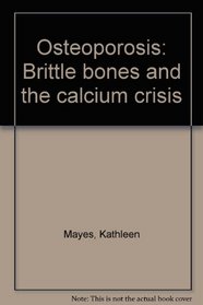 Osteoporosis: Brittle bones and the calcium crisis