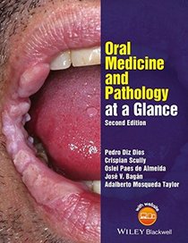 Oral Medicine and Pathology at a Glance (At a Glance (Dentistry))