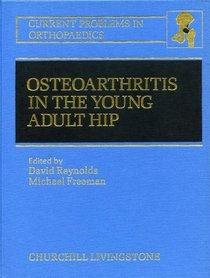 Osteoarthritis in the Young Adult Hip: Options for Surgical Management (Current Problems in Orthopedics)