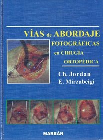 Vias de Abordaje Fotografiacas En Cirugia Ortopedica (Spanish Edition)