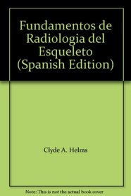 Fundamentos de Radiologia del Esqueleto (Spanish Edition)