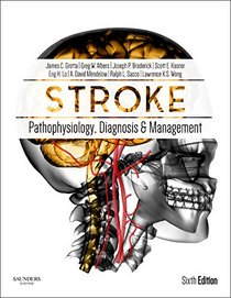 Stroke: Pathophysiology, Diagnosis, and Management