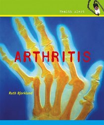 Arthritis (Health Alert)