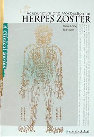Acupuncture and Moxibustion for Herpes Zoster (Clinical Practice of Acupuncture and Moxibustion)
