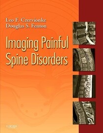 Imaging Painful Spine Disorders - Expert Consult