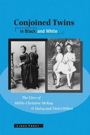 Conjoined Twins in Black and White: The Lives of Millie-Christine McKoy and Daisy and Violet Hilton (Wisconsin Studies in Autobiography)