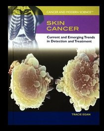 Skin Cancer: Current and Emerging Trends in Detection and Treatment