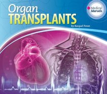 Organ Transplants (Medical Marvels)