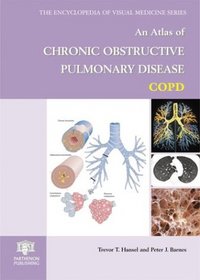 An Atlas of Chronic Obstructive Pulmonary Disease (Encyclopedia of Visual Medicine Series)