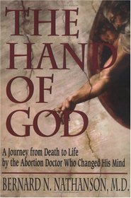 The Hand of God : A Journey from Death to Life by the Abortion Doctor Who Changed His Mind