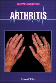 Arthritis (Diseases and People)