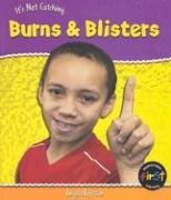 Burns and Blisters (Heinemann First Library)