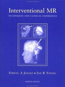 Interventional MR: Techniques, methods and clinical experiences