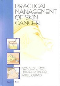 Practical Management of Skin Cancer