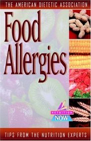 Food Allergies : Up-to-Date Tips from the World's Foremost Nutrition Experts