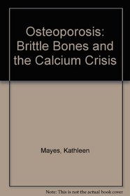 Osteoporosis: Brittle Bones and the Calcium Crisis