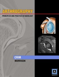 Arthrography: Principles & Practice in Radiology: Published by Amirsys (Specialty Imaging)