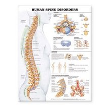 Human Spine Disorders Anatomical Chart