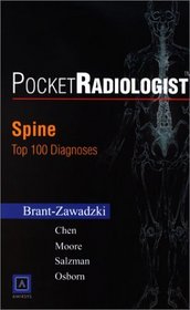 Spine: 100 Top Diagnoses (Pocketradiologist)